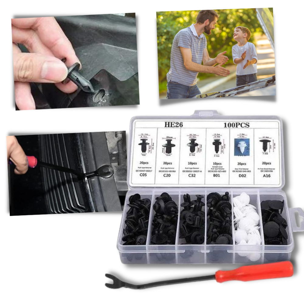 Kit de clips pour panneau de porte de voiture